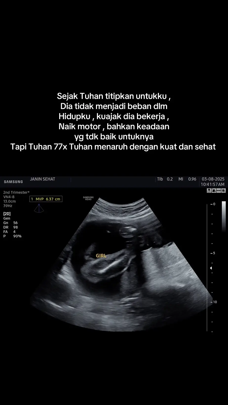 Kalau bukan titipan yang kuat mungkin dia sudah tidak ada 🥰 #ibuhamil #iburumahtangga #ibuhebat #pejuanggarisdua 