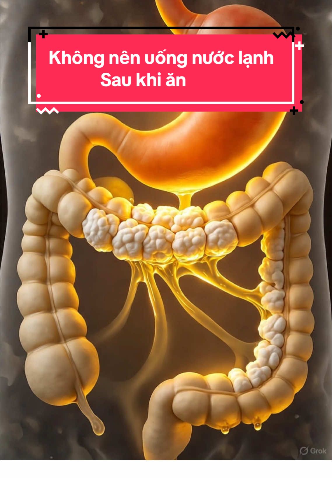 MẸO SỨC KHỎE #2: ĐỪNG BAO GIỜ UỐNG NƯỚC LẠNH SAU KHI ĂN Bạn có bao giờ để ý, sau bữa ăn no nê, chúng ta thường tìm đến một ly nước lạnh để “giải ngấy”? Nhưng ít ai biết rằng, chính ly nước tưởng như vô hại ấy lại là nguyên nhân khiến cơ thể mệt mỏi, bụng trướng và tiêu hóa chậm. Khi nước lạnh đi vào dạ dày, nó làm cho chất béo trong thức ăn đông lại, giống như dầu mỡ gặp lạnh thì đóng cục. Những cục mỡ nhỏ ấy không biến mất, mà bám lại trên thành ruột, khiến hệ tiêu hóa phải làm việc gấp đôi. Lâu dần, bạn sẽ thấy mình đầy hơi, khó tiêu, và thậm chí là tăng cân dù ăn ít. Trong khi đó, chỉ cần đổi nước lạnh thành nước ấm khoảng bốn mươi độ, mọi thứ sẽ thay đổi hoàn toàn. Nước ấm giúp dạ dày thư giãn, kích thích lưu thông máu và làm mềm các chất béo, khiến quá trình tiêu hóa diễn ra êm ái và nhanh hơn. Không chỉ vậy, nước ấm còn giúp da sáng hơn, giảm tích tụ độc tố và khiến cơ thể nhẹ nhõm, dễ chịu. Đó là lý do vì sao người Nhật và người Hàn – những dân tộc nổi tiếng sống lâu – luôn uống nước ấm sau bữa ăn, chứ không bao giờ dùng nước lạnh. Vậy nên, lần tới khi ăn xong, đừng vội tìm đến ly nước mát. Hãy thử đổi sang nước ấm, bạn sẽ cảm nhận rõ sự khác biệt chỉ sau vài ngày. Một thói quen nhỏ, nhưng có thể thay đổi sức khỏe cả đời. Nếu bạn cũng sẽ thử từ hôm nay, hãy ấn tim, chia sẻ video này để nhiều người biết hơn, và đừng quên follow kênh Mẹo Sức Khỏe để nhận thêm những bí mật giúp cơ thể luôn trẻ – khỏe – đẹp mỗi ngày. #suckhoe #meo 