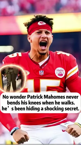 No wonder Patrick Mahomes never bends his knees when he walks—he’s been hiding a shocking secret. 