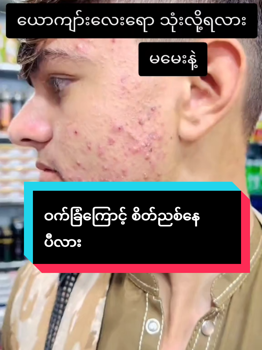 #ယောကျာ်းလေးတွေဝက်ခြံကြောင့်မရှက်နဲ့တော့#သလဲသီးမျက်နှာသစ်ဆပ်ပြာ #အိမ်ရောက်ငွေချေနဲ့ပို့ပေးပါတယ် #fpy #thae 