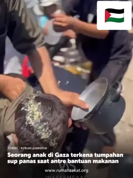 Free Palestine 🇵🇸 #freepalestine🇵🇸❤️ #foryoupage #xbcyza #viral 
