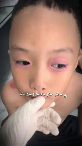 #CapCut vậy nên thể nghịch sau khi điều trị một ngày bé ra khỏi hoàn toàn #viral 