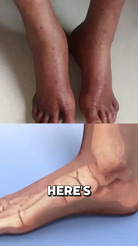 Struggling with Swollen, Achy Feet? Forget the ice packs and endless elevation — Soleva uses targeted heat, gentle compression, and massage