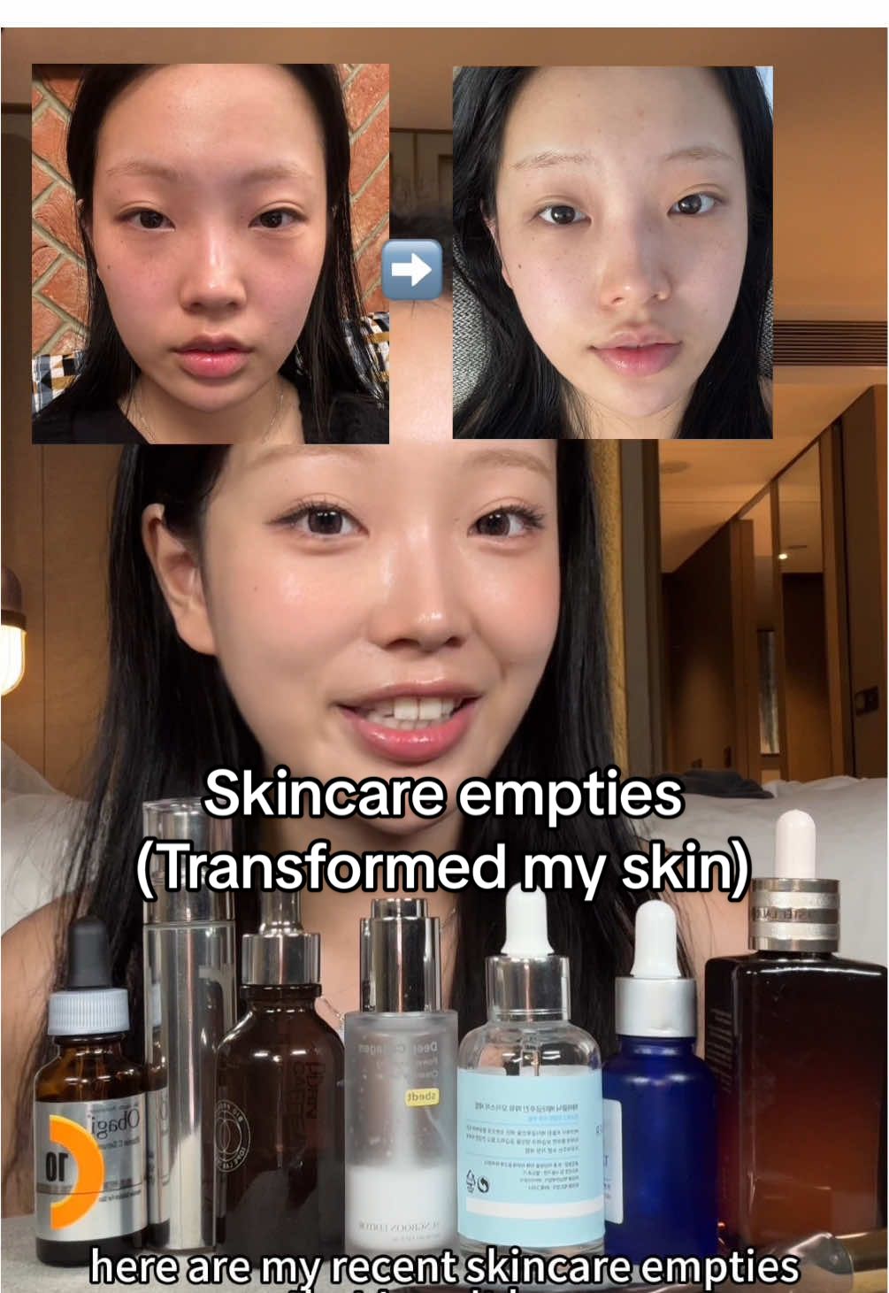 Filler serum that got rid of my smile line and under eye sureness?!@SUNGBOON EDITOR  ad #amazonprimeday #sungboonpartner #collagenserum #volufiline #glassskin 