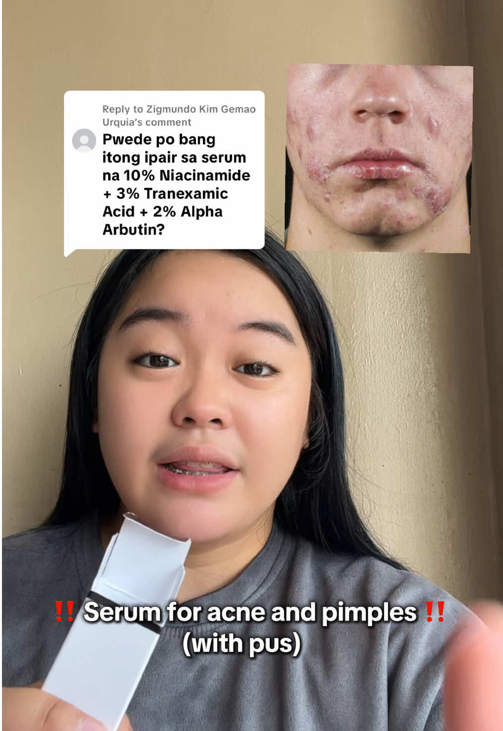 Replying to @Zigmundo Kim Gemao Urquia yes effective sa face  #dermorepubliq #dermorepubliqserum #serumviral #serum