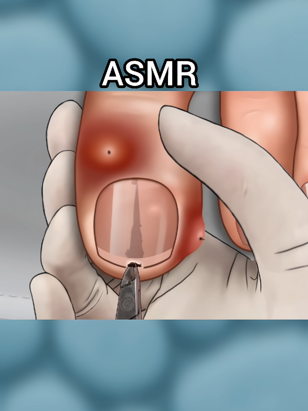 ASMR Treatment #asmr #ukdoctor #SatisfyingVideo #viraltiktok #relaxingvideos 