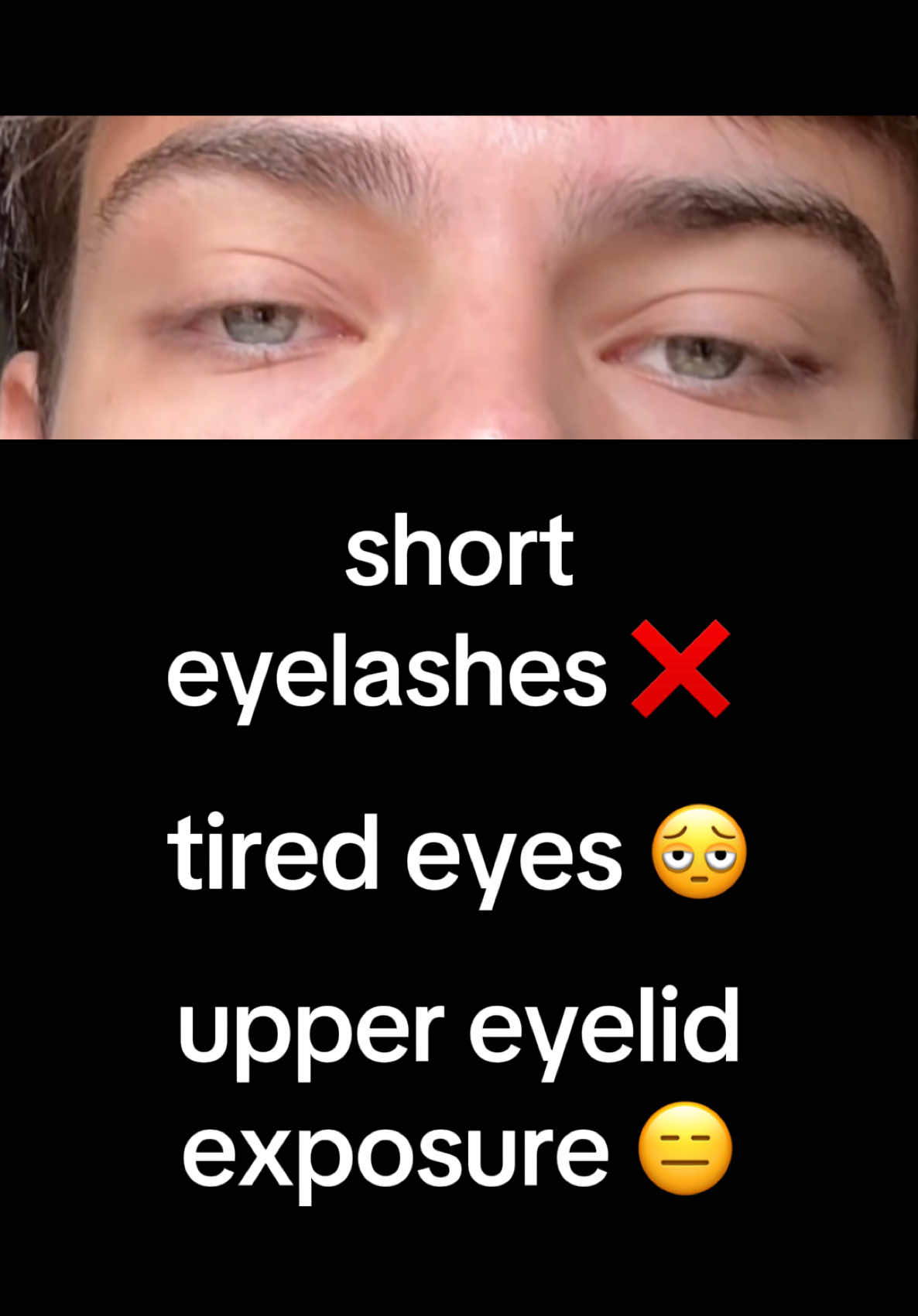 how to fix your eyes #mog #eyes #GlowUp 