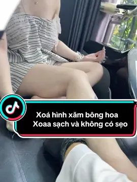 Xoá hình xăm cho em khách #xoá_xăm #xoaxamkhongseo #hảiphòng #suhuongtiktok #xoáhìnhxăm 