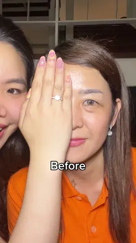 Gak perlu oplas lagi🙂‍↔️ #drjou #fypage #kerutan #fyppppppppppppppppppppppp #fyp 