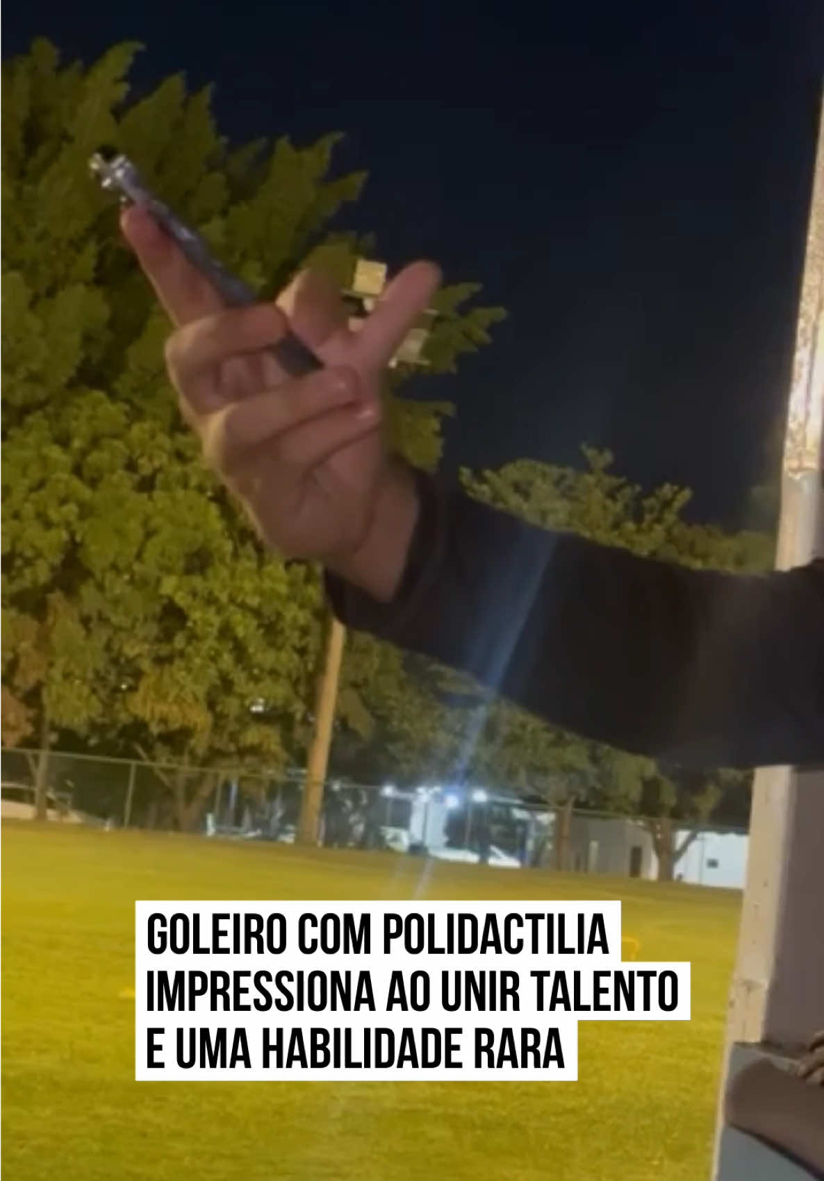 ⚽🥅 Durante um #treino em uma escola de #goleiros, um vídeo curioso chamou a atenção da internet.  João, apelidado de “João 6 Dedos”, apareceu mexendo no celular, até aí, tudo normal. O que surpreendeu mesmo foi o detalhe: ele tem seis dedos em cada mão, todos funcionais.   A reação dos colegas foi imediata e cheia de espanto. “Eu já vi de tudo, mas isso eu nunca imaginei”, disse um dos amigos. A condição genética de João, chamada polidactilia, virou assunto nas #redes, acompanhada de elogios e brincadeiras sobre a “vantagem” extra no gol.  #TikTokNotícias 📹 @Goleiroraiz00 | @myhoodbr