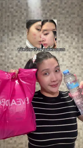แชร์ทริครักษาสิวตามที่หมอแนะนำ 🫶🏻💖🌿 #รักษาสิว #สกินแคร์รักษาสิว #ล้างหน้าด้วยน้ําเปล่า 