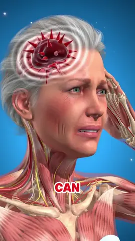 Here’s how to use the FAST method to detect a stroke quickly #stroke #brain #healthtip #usa #fast 
