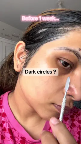 Glowy in 7 days?? @Mary&May Official @Mary&May Influencers  #marynmay #marynmaypopchallenge #kbeauty #hyperpigmentation #glowingskin 