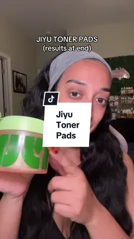 Believe all the hype around JIYU toner pads ive noticed a difference with scarring and texture ! 