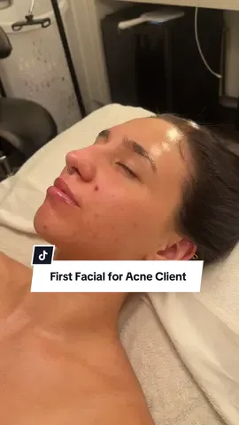 I noticed this client may be having break out due to skin barrier issues. I can see this due to the red splotches on her other cheek. You can see a glimpse of it at the end of the video. Since she has never had a facial before, I wanted to keep it nice and gentle before using any actives for acne treatment. Hopefully, she comes back for another facial or acne treatment 🤍 #acnetreatment #acnefacial #skinbarrier #yyc #koreanfacial