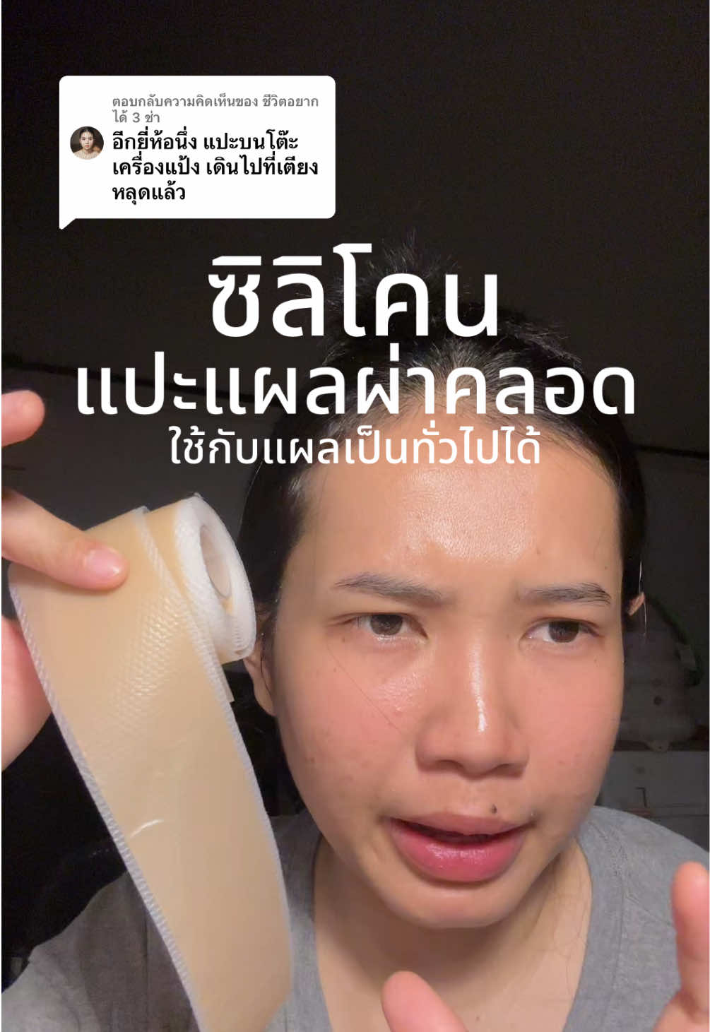 ตอบกลับ @ชีวิตอยากได้ 3 ช่า แปะรอยแผลเป็นนูน