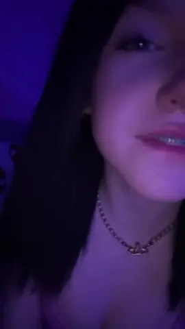 can I get one? 💋 #kiss #braces  #xyzbca #viral #agegap 