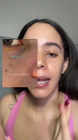#tiktokshopcreatorpicks #skin1004 #bigpores 