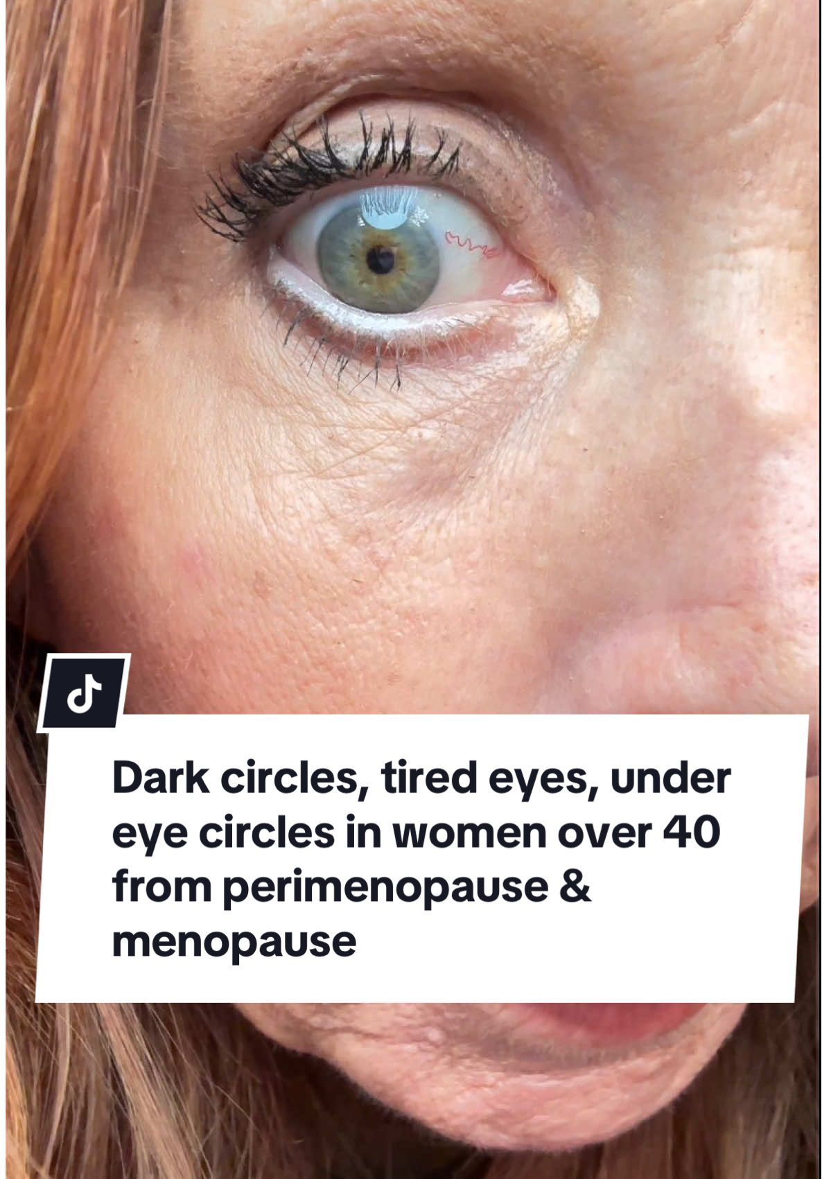 Dark circles, tired eyes, under eye circles in women over 40 from perimenopause & menopause are not fun to deal with every day! Over 40 women struggle with under eye circles, fine lines, and tired looking skin. This under eye corrector instantly brightens without heavy makeup. If you’re dealing with dark circles too, save this video or share it with a friend🫶🏼 #DarkCirclesOver40 #TiredEyesFix #MenopauseSkinCare #PerimenopauseBeauty #AgingSkin 