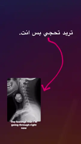 #🗿 #الشعب_الصيني_ماله_حل😂😂 #مشاهير_تيك_توك #جيش_حسحس #اكسبلور 