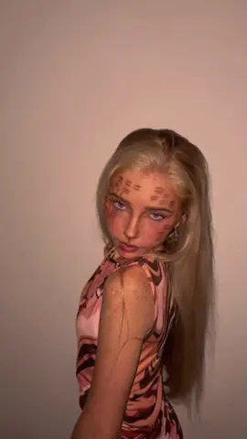 #freckelface #imhotandurnot #viral #fyp 