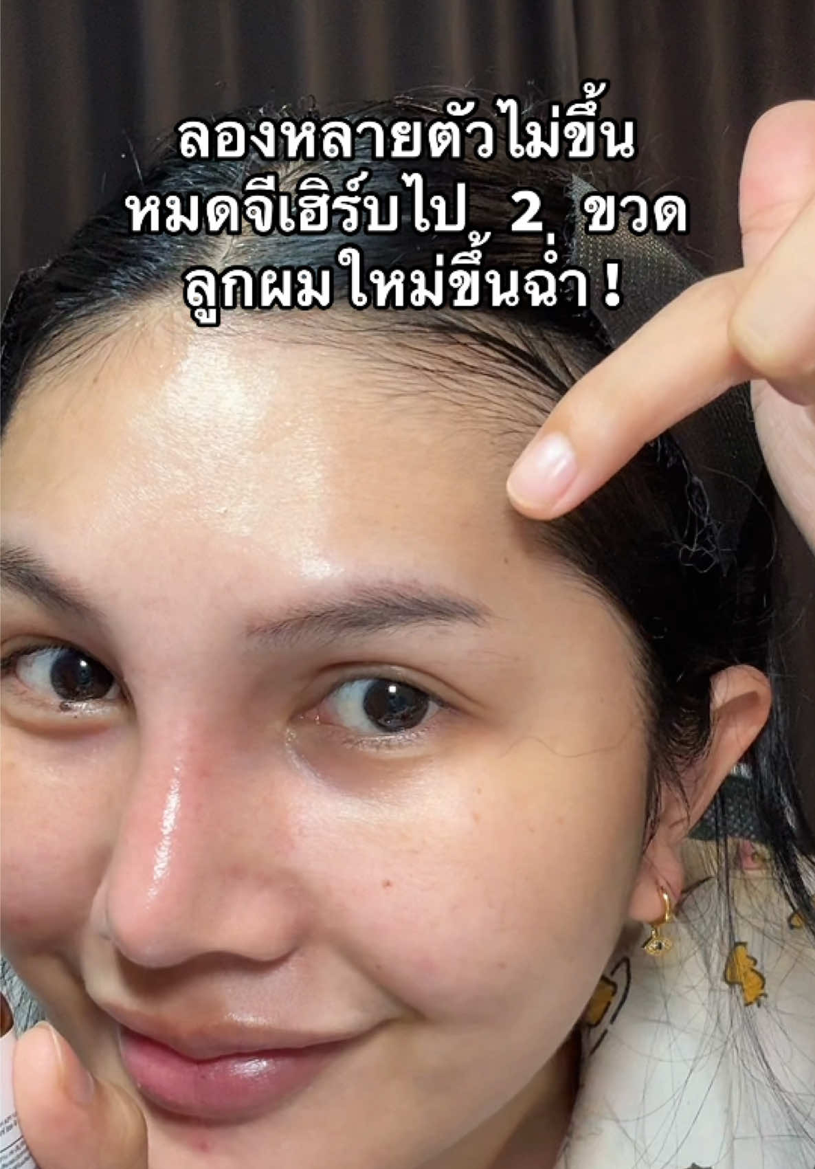 #แฮร์โทนิค #แฮร์โทนิคจีเฮิร์บ #จีเฮิร์บ #ผมขึ้นใหม่ 
