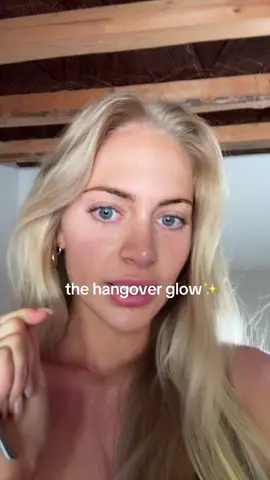 woke up today not with hangover glow😔😔