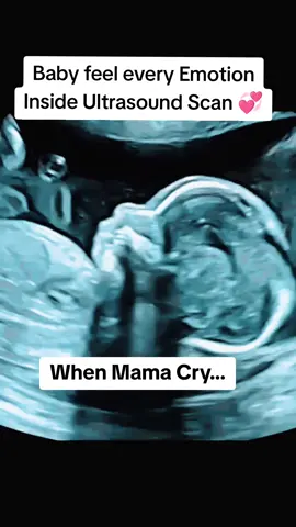 baby feel every emotion ultrasound scan #pregnancyultrasound #ultrasoundbaby💕 #babyultrasound🤰✔️ #babyinwomb☺ #babyintummy❤️ 