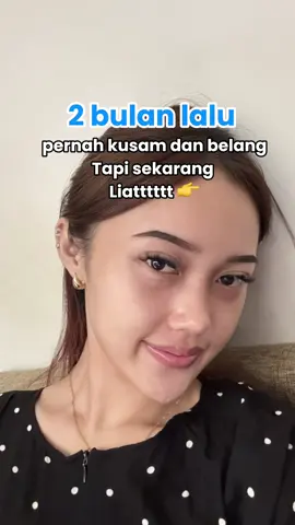 Buruan co sekarang juga‼️‼️ #promomakan1010 #luxskin #glutathione #fyp 