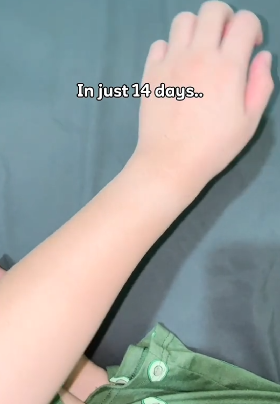 Amazing results 👏 👌 #fyp #zuwacosmetics #zuwacosmeticsproducts #tiktoknepal #kojicwhitening 