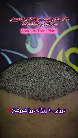 #CapCut ئەوەیە چاندمەوەی جوان و زەمان دووای ١٠ رۆژ   #sarkawt_hair_transplant #soran #sarkawt_beauty_center #fyb 