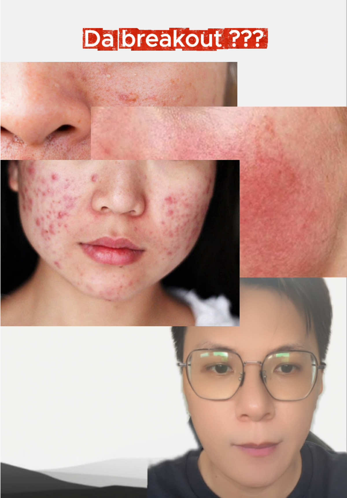 Sửa rửa mặt Simple dịu nhẹ chân ái cho da breakout, da nhạy cảm #Simple #hoptaccungunilever #suaruamat #srm #xh 