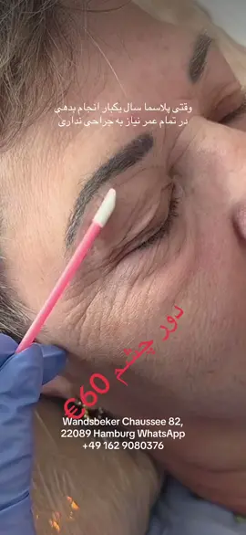 #videoviral #plasma #kollagenbeauty #plasmalift #پاکسازی_پوست_همراه_با_آب_رسانی_جوانسازی 