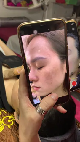 Thực tế khách nám #chamsocdaseo#chamsocda#chamsocdamun#chamsocdanam#tanbinh      