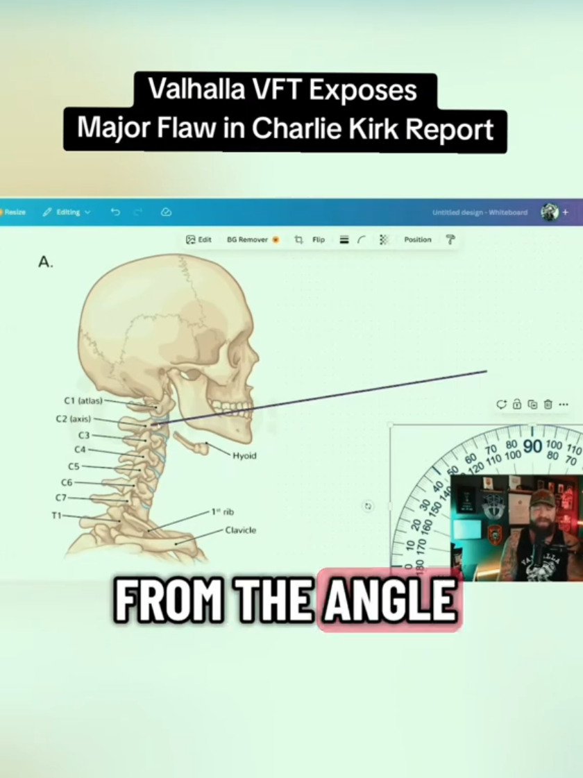 🚨 BREAKING: Valhalla VFT just released an in-depth breakdown on the official coroner’s report tied to the Charlie Kirk incident — and his analysis is raising serious questions. According to Valhalla, the report claims that Charlie was struck through the C2 vertebrae, but when he overlays the anatomy and trajectory physics, the angles simply don’t add up. If that vertebra had been hit directly, Valhalla argues, the impact would’ve aligned much higher — potentially at the jaw or face level — not where the visible injury appeared on camera. This latest drop is already blowing up online, with people debating whether there’s a major inconsistency in the official account or just a misunderstanding in how the report was written. Valhalla has proven himself to be one of the most methodical and fair creators covering this story, so his findings are getting serious traction tonight. 👀 Drop your theories below — what do you think is going on here? Is this a case of human error, or is there more to it than we’ve been told? Follow ValhallaVFT for the full video and follow this page for updates as the discussion continues. #ValhallaVFT #CharlieKirk #BreakingNews 