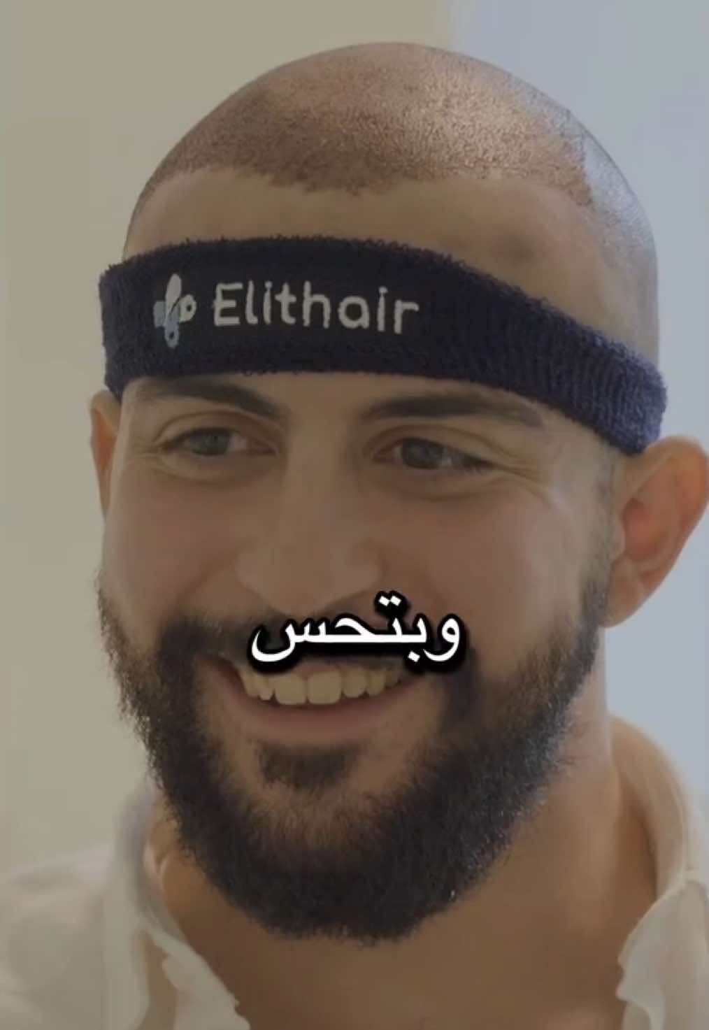 بصراحة، طول فترة كنت متردد… كنت فكر إنو زراعة الشعر شي مؤلم أو صعب، بس يلي اكتشفته فاجأني! من أول لحظة دخلت مركز @Elithair.ar | إليت هير  حسّيت براحة ما بتنوصف. الفريق محترف، المعاملة راقية، وكل شي  منظم لأدق التفاصيل إذا عم تفكر تعمل زراعة شعر، صدّقني  التجربة أهون بكتير مما تتخيل #fyp #تيك_توك #عرب #المانيا #تركيا 