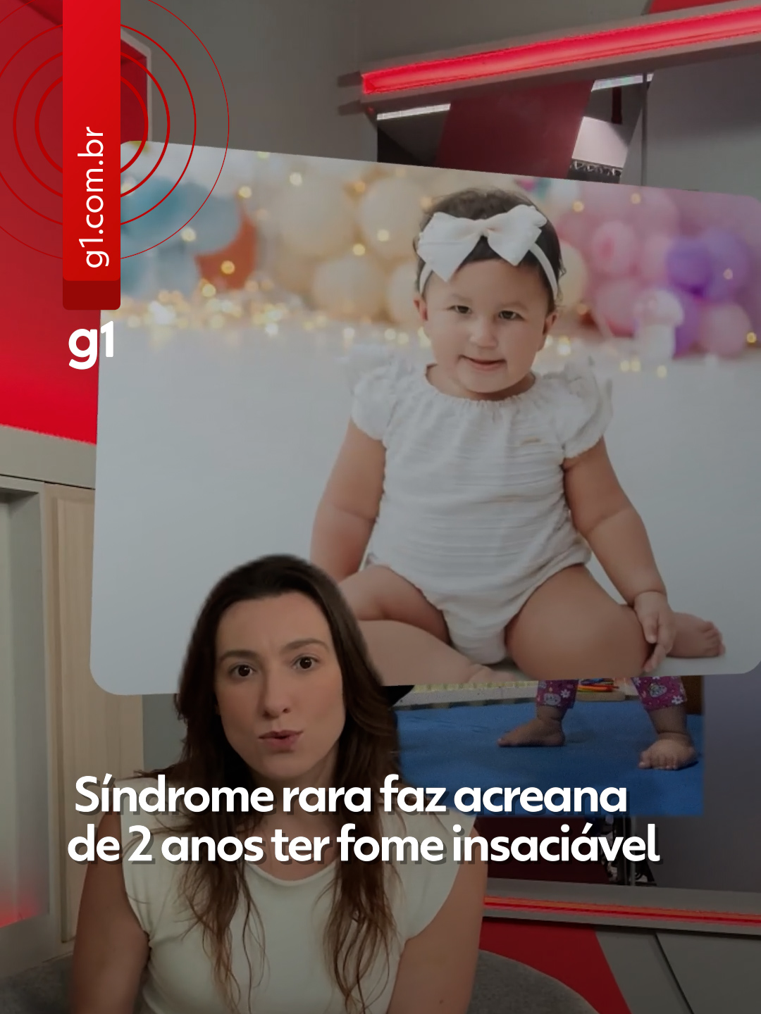 Síndrome rara - A condição genética rara da criança Melinda Paulo Lima Machado, de apenas 2 anos, gerou repercussão após a família revelar que a menina enfrenta a Síndrome de Prader-Willi (SPW), que causa fome insaciável, atraso no desenvolvimento e alterações hormonais. Melinda, que já pesa 15 quilos, considerado acima da média para a idade, precisa de acompanhamento médico multidisciplinar. Os pais, por sua vez, correm contra o tempo para a menina ter, dentre as limitações, a melhor qualidade de vida possível. O g1 conversou com a endocrinologista pediátrica Ruth Rocha Franco, da Associação Brasileira da Síndrome de Prader-Willi (SPW Brasil), que explicou que o diagnóstico precoce e o início do tratamento adequado podem fazer toda a diferença no desenvolvimento das crianças, já que não há cura para a condição e requer cuidados constantes. Clique em 'leia o artigo' para ler a reportagem completa. #Acre #g1local #g1 #tiktoknotícias