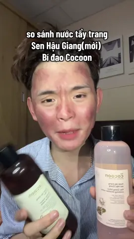 Có ai bị dắt không nò?🥰