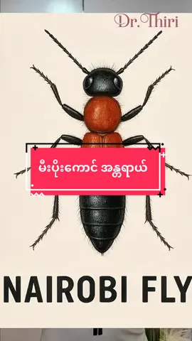မီးပိုးကောင် အန္တရာယ် 🐜 ဒီ video ထဲမှာ  🩺မီးပိုးကောင်အဆိပ်နဲ့ထိတွေ့မိတဲ့အခါ ပြုလုပ်ရမယ့်ကုသနည်း.. 🩺မီးပိုးကောင်နဲ့မထိတွေ့ရအောင် ကာကွယ်နည်းတွေကို မျှဝေပေးထားပါတယ်ရှင်.. အကယ်၍ မီးပိုးကောင်အဆိပ်နဲ့ထိတွေ့မိတဲ့နေရာက 👀မျက်လုံး 🤦‍♀️မျက်နှာ (သို့)  🧑‍⚕️ဖြစ်တဲ့နေရာကကြီးတယ်ဆိုဆရာဝန်နဲ့ပြသပြီးလိုအပ်တဲ့ သောက်ဆေး၊လိမ်းဆေးအပြင် အခြေအနေပြင်းထန်လျှင်ထိုးဆေးဖြင့်ပါ ကုသနိုင်ပါတယ်ရှင်.. #drthiri #မီးပိုးကောင် #skinhealth #fyp #viral 