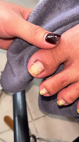 Da thì thôi nhé 😅😅