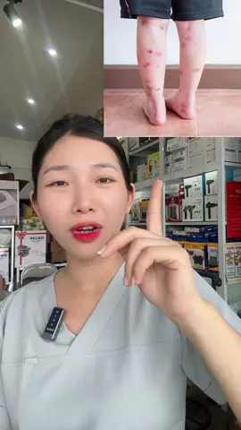 Riêng em kem bôi này là Uy tín luôn nha các mẹ ơi. Chân ái k thể thiếu để bảo vệ các con mọi lúc mọi nơi #xuhuong #kemngaicuuvagung 