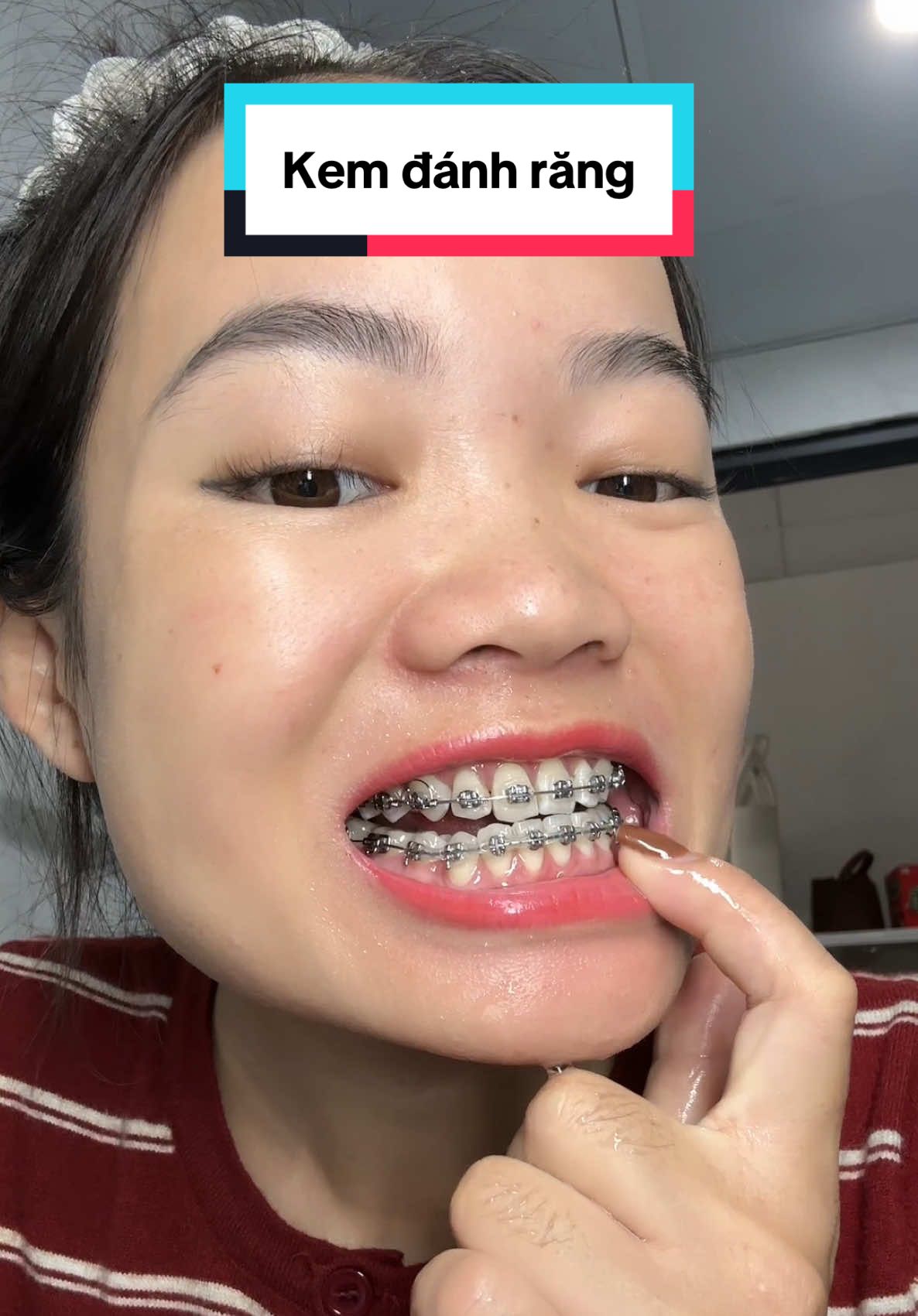 Răng trắng sáng hơi thở thơm mát #kemdanhrang #kemdanhrangcloseup #closeup #nhannhonhan98 