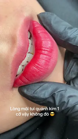 Trúc Anh nói không với kim nhiều 🥰 