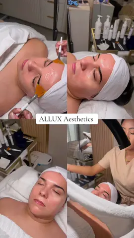 Who doesn’t want clear skin? Prioritize self care @Kelsey | Coral Springs Esti 🤍 #fyp #DermaplaneFacial #fypシ 