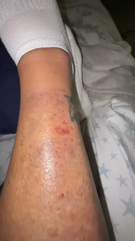 One night. One cream. The difference still shocks me 😳✨ @MyMagicHealer #tiktokshopfalldealsforyou #tiktokshopcreatorpicks #tiktokshopblackfriday 