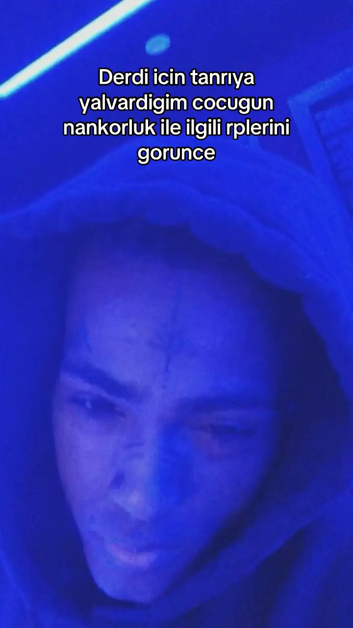 Oylemiolmus #xxxtentacion 