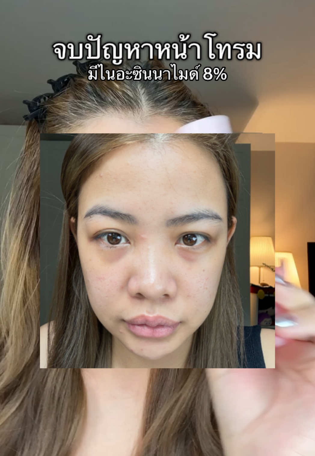 จบปัญหาหน้าโทรม น้ำตบจบโทรม #glamน้ําตบจบโทรม #น้ําตบจบโทรม #glamm #ป้ายยาสกินแคร์ 