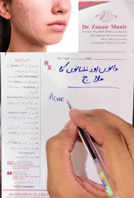 Acne treatment suggested by doctor Zunair Munir Zunair Aesthetic samanabad Bilal Chowk Faisalabad #foryou #foryoupage #fyp #viral #trending 