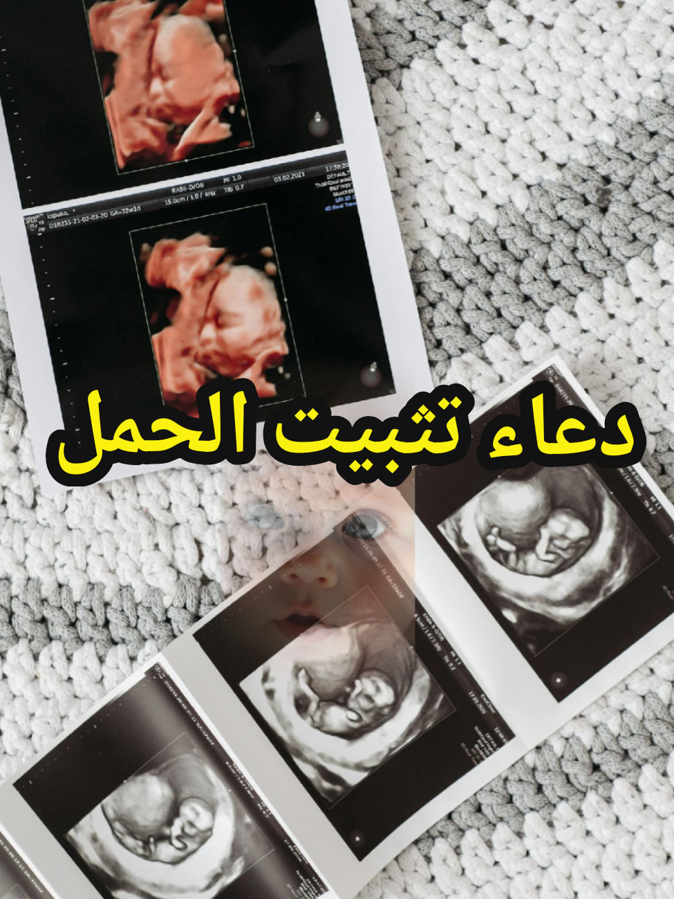 شارك دعاء تثبيت الحمل لمن تسقط #دعاء #الحمل 