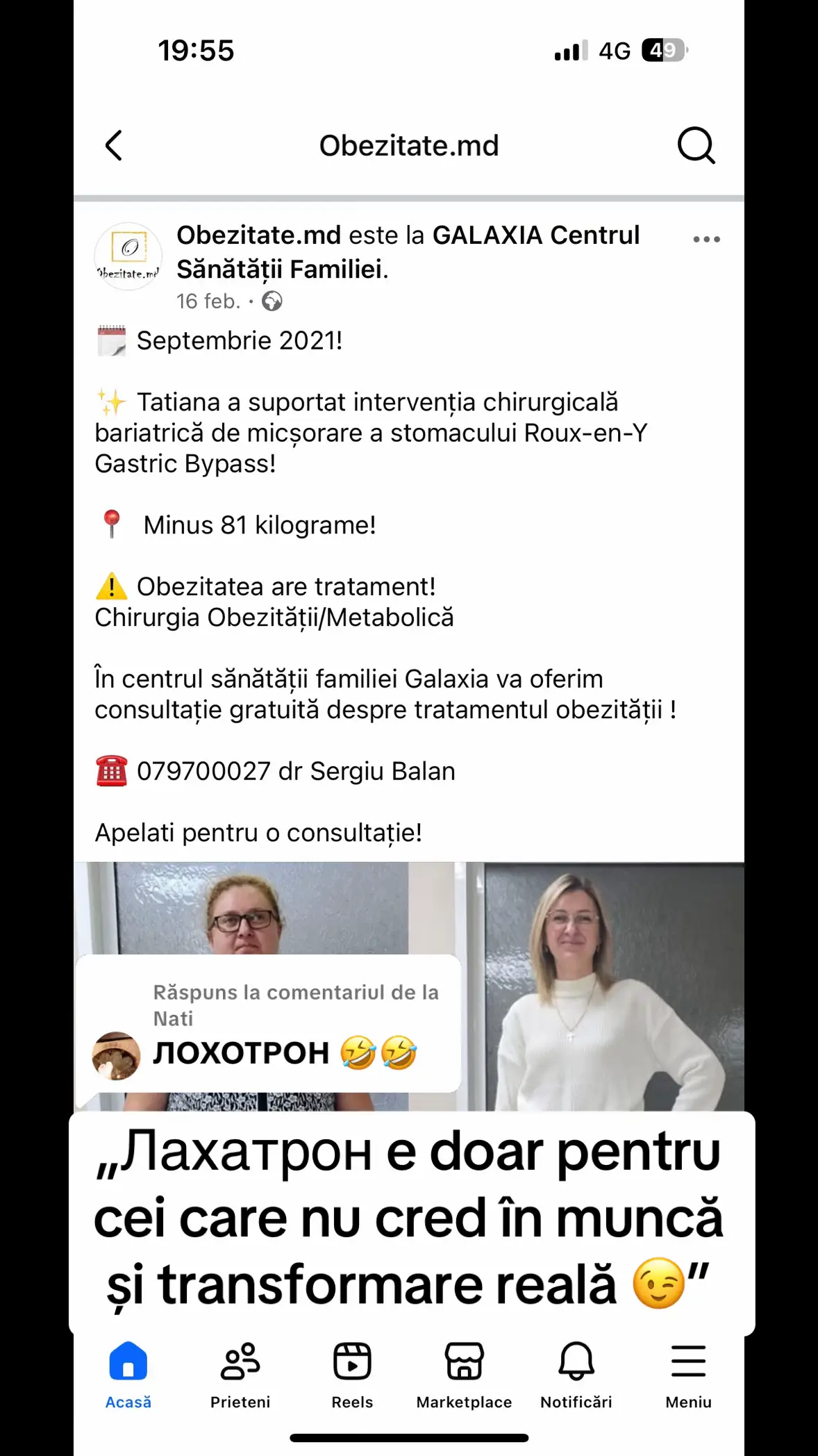 Ca răspuns pentru @Nati #obezitate #slabit #dupăOperație #târziudarperfectă #bariatricsurgery 